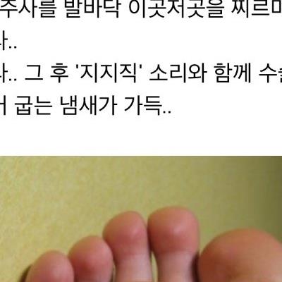 심한혐. 발바닥 티눈 제거. 스압주의.피주의.