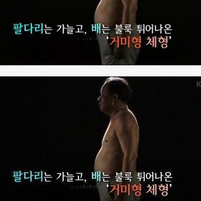 의사가 말하는 위험한 체형.